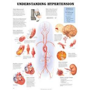 Hypertension Anatomical Chart  Industrial & Scientific