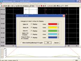 Ambulatory EEG,AEEG,analysis system,upload device  