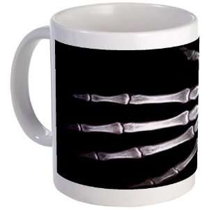  Hand X Ray Medical Mug by 