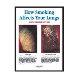  How Smoking Affects Your Lungs Chart, Framed