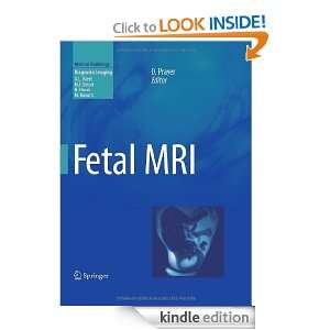 Fetal MRI (Medical Radiology / Diagnostic Imaging) Daniela Prayer 